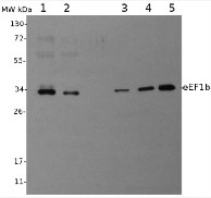 eEF1b | Elongation factor 1-beta in the group Antibodies for Plant/Algal  / DNA/RNA/Cell Cycle / Translation at Agrisera AB (Antibodies for research) (AS07 265)